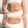 Skin Tightening Gel